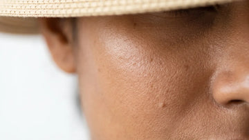 Close-up of a cheek with small sun spots under a straw hat brim